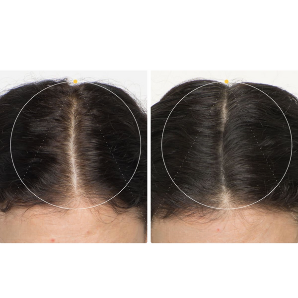 Mediceuticals zestaw do pielęgnacji suchych włos&oacute;w i sk&oacute;ry głowy z tendencją do przerzedzania dla mężczyzn (Hydraclenz&trade; 250ml, Therapeutic&trade; 250ml, Numinox&trade; 125ml) 51008 zdjęcia